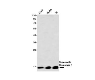 Recombinant Superoxide Dismutase 1 Monoclonal Antibody