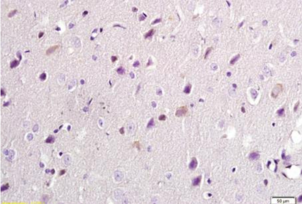 Malondialdehyde Monoclonal Antibody