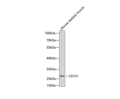 Anti-Human CD151 Monoclonal Antibody