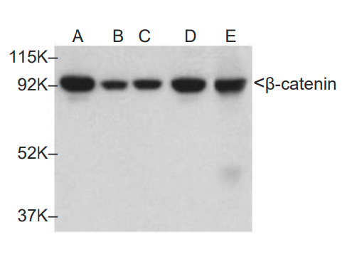 β-catenin (H-1): MDB133240