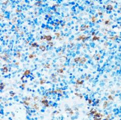 Anti-FGFR2 antibody (1-100) (MDB23658)