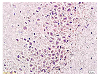 Anti-TNF alpha antibody (AA 181-235)