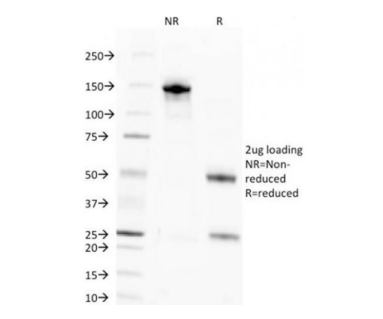 Anti-Nuclear Antigen (Pan-Nuclear Marker) Antibody