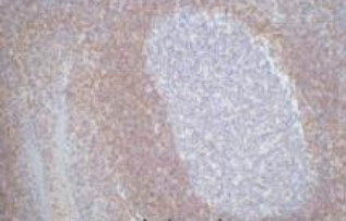 Anti-Human BCl2 Monoclonal Antibody