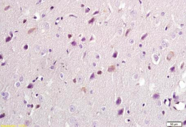 Malondialdehyde Monoclonal Antibody