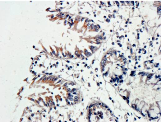 VEGF Mouse Monoclonal Antibody (MDB0113AB)